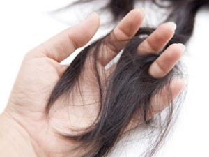 hair loss